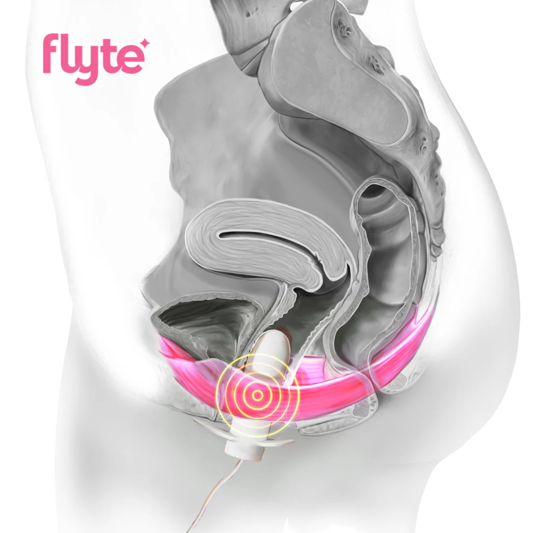 Flyte In-Home Pelvic Floor Therapy - Image 3